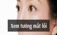 Xem tướng mắt lồi ở đàn ông và phụ nữ trong nhân tướng